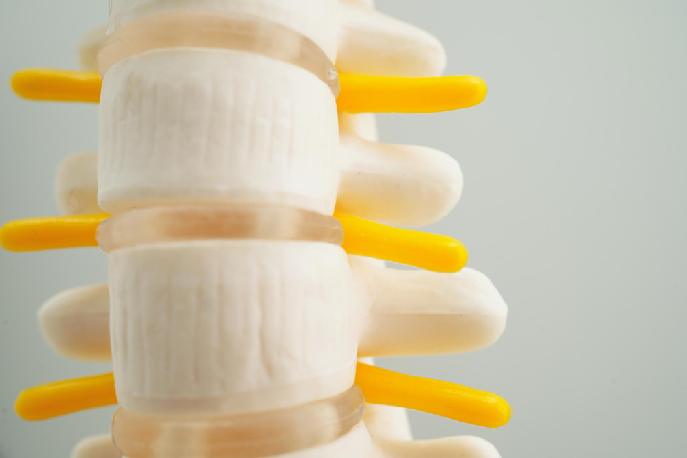Degenerative Disc Disease Treated in Bakersfield